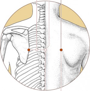 BL 44