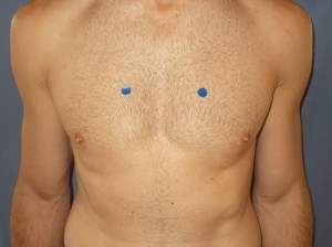 2.18